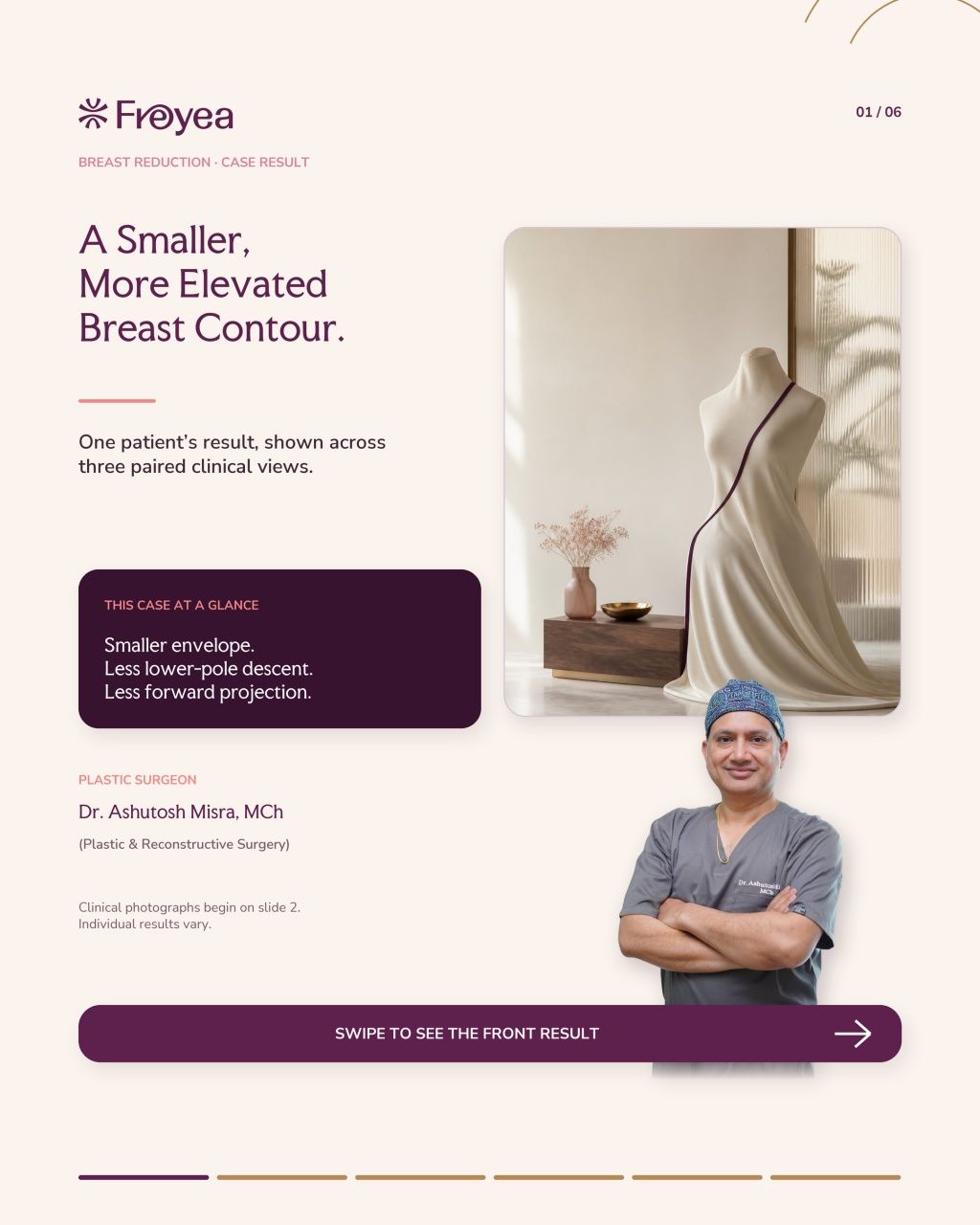 What Actually Happens in a Breast Reduction Consultation - Result 1