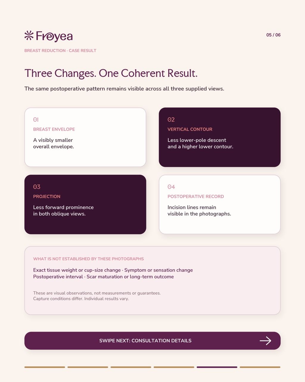 What Actually Happens in a Breast Reduction Consultation - Result 5
