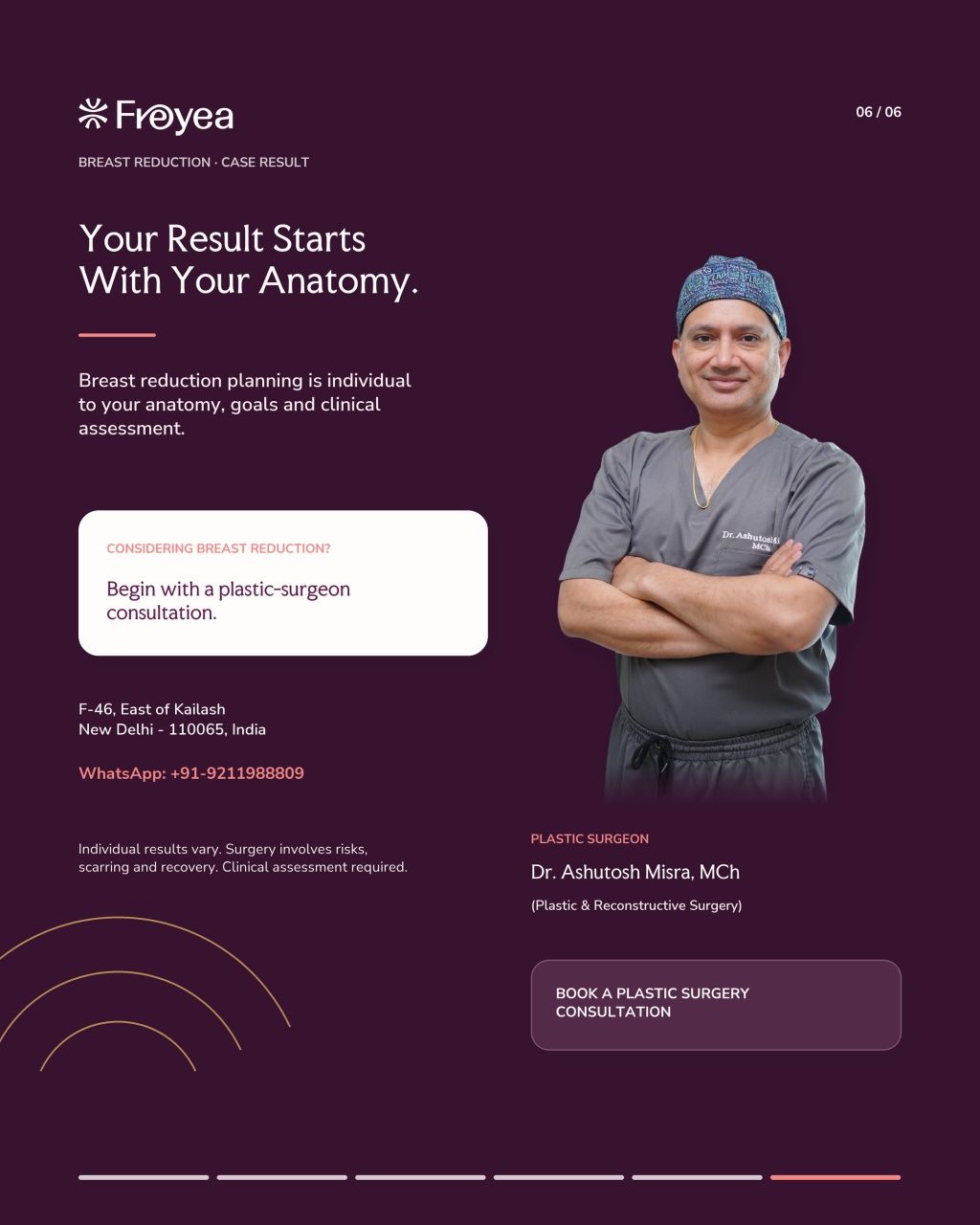 What Actually Happens in a Breast Reduction Consultation - Result 6