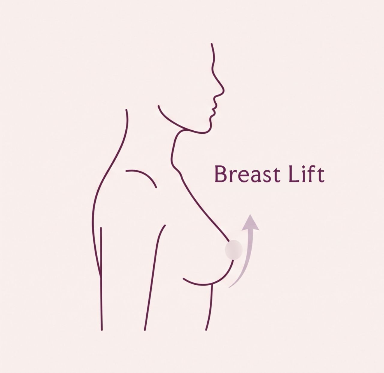 Click to expand What a Breast Lift (Mastopexy) Actually Does