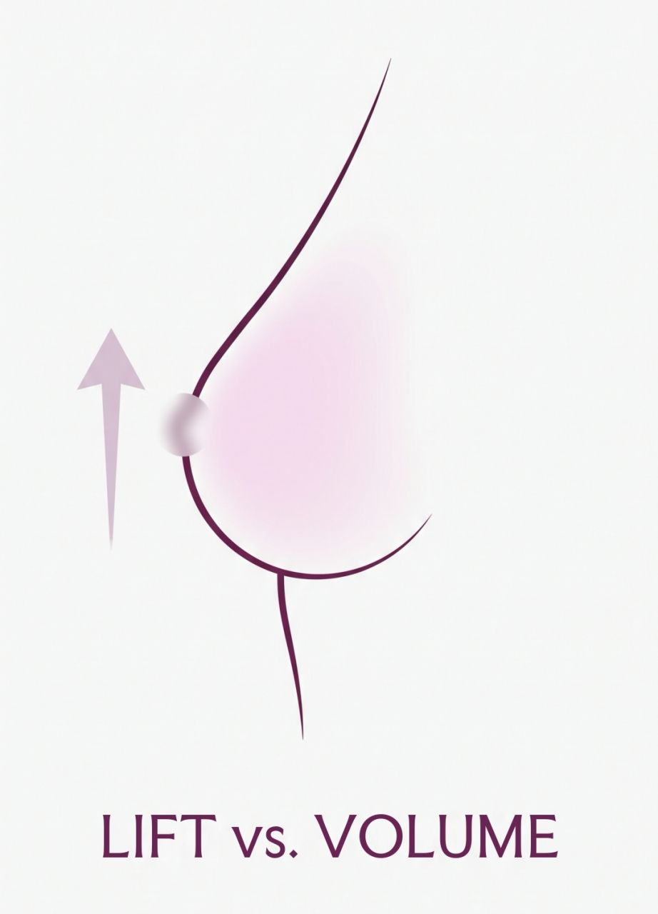 Click to expand Volume Loss vs Breast Ptosis