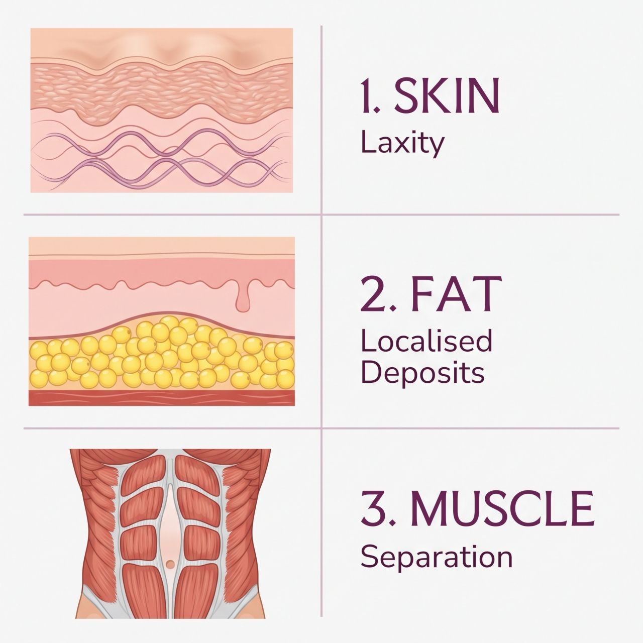 Comparing Tummy Tuck and Liposuction